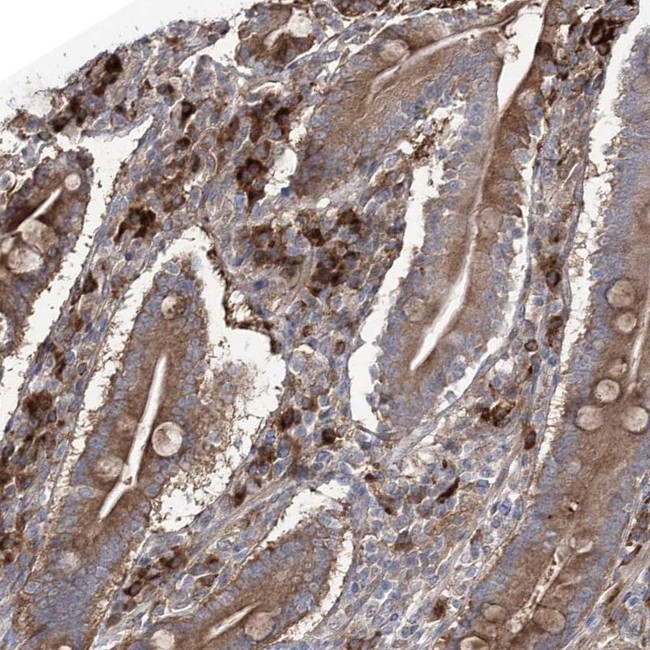OTUD1 Antibody in Immunohistochemistry (IHC)