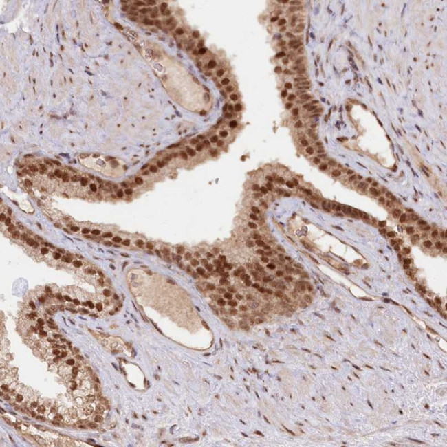 CCDC65 Antibody in Immunohistochemistry (Paraffin) (IHC (P))