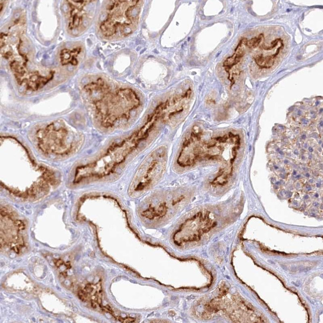 ALDH3B1 Antibody in Immunohistochemistry (Paraffin) (IHC (P))