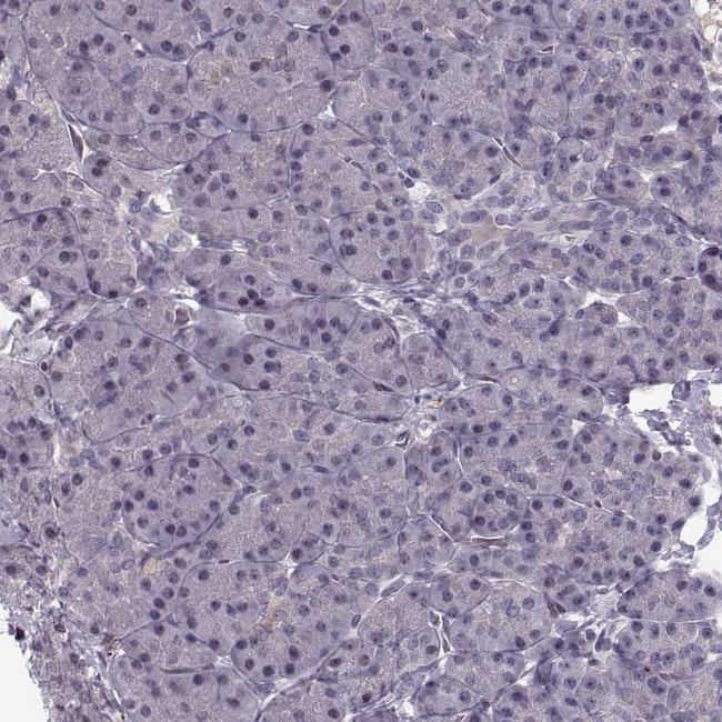 WDR63 Antibody in Immunohistochemistry (Paraffin) (IHC (P))
