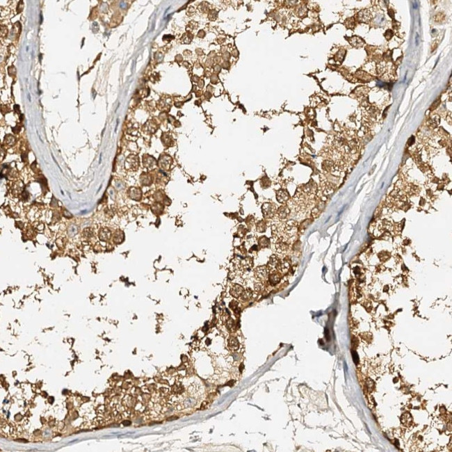 METTL12 Antibody in Immunohistochemistry (Paraffin) (IHC (P))