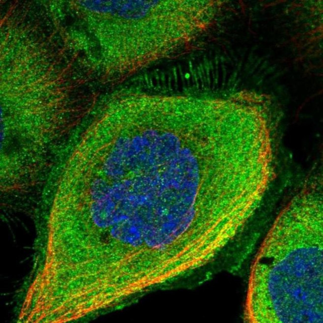 DDIAS Antibody in Immunocytochemistry (ICC/IF)