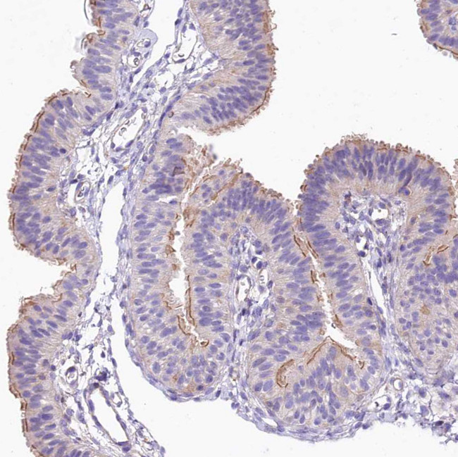 FCHSD2 Antibody in Immunohistochemistry (Paraffin) (IHC (P))