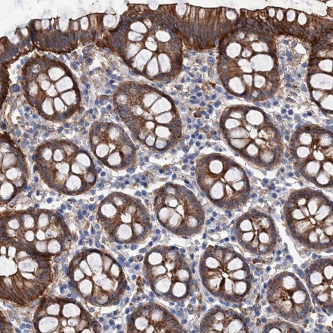 TMTC3 Antibody in Immunohistochemistry (Paraffin) (IHC (P))