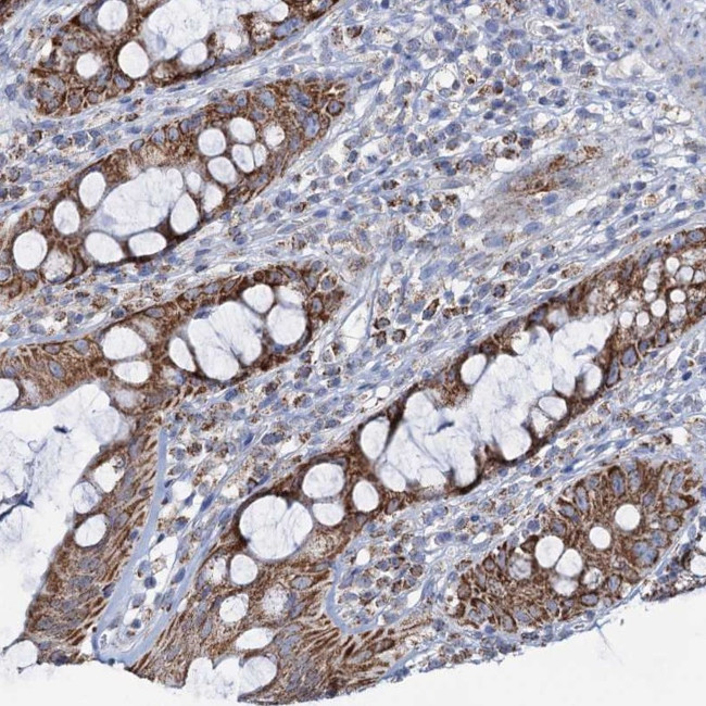 C2CD3 Antibody in Immunohistochemistry (Paraffin) (IHC (P))