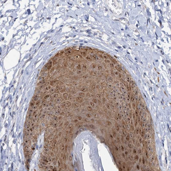 C2CD3 Antibody in Immunohistochemistry (Paraffin) (IHC (P))