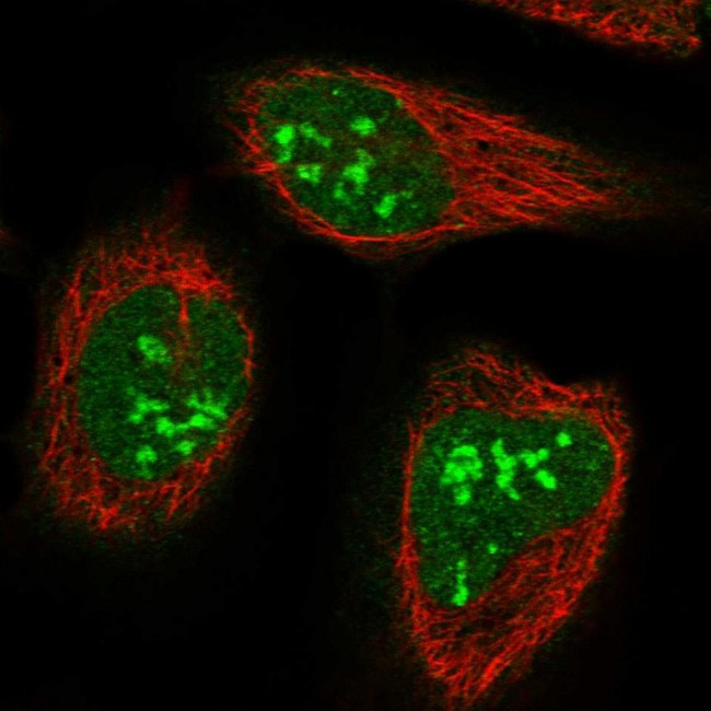 TAP26 Antibody in Immunocytochemistry (ICC/IF)