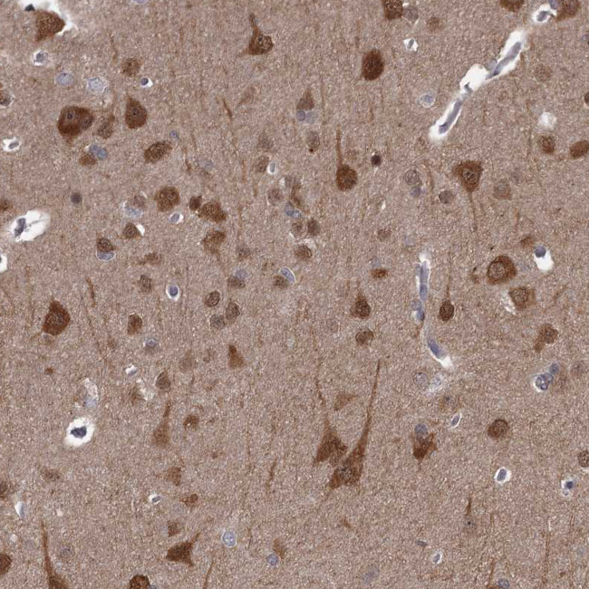 CCDC92 Antibody in Immunohistochemistry (Paraffin) (IHC (P))