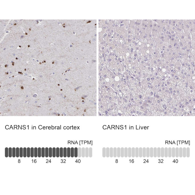 ATPGD1 Antibody in Immunohistochemistry (IHC)