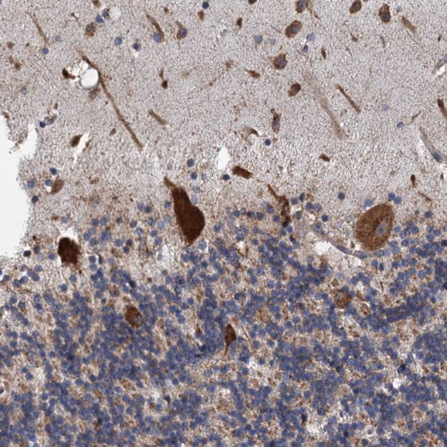 LINS Antibody in Immunohistochemistry (Paraffin) (IHC (P))