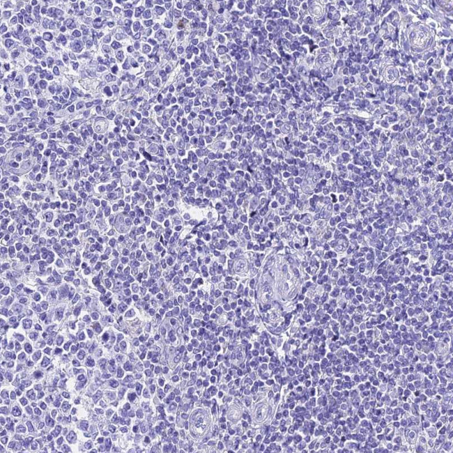 ICEBERG Antibody in Immunohistochemistry (Paraffin) (IHC (P))