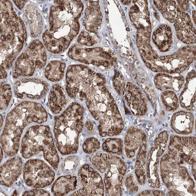 ACTR6 Antibody in Immunohistochemistry (Paraffin) (IHC (P))