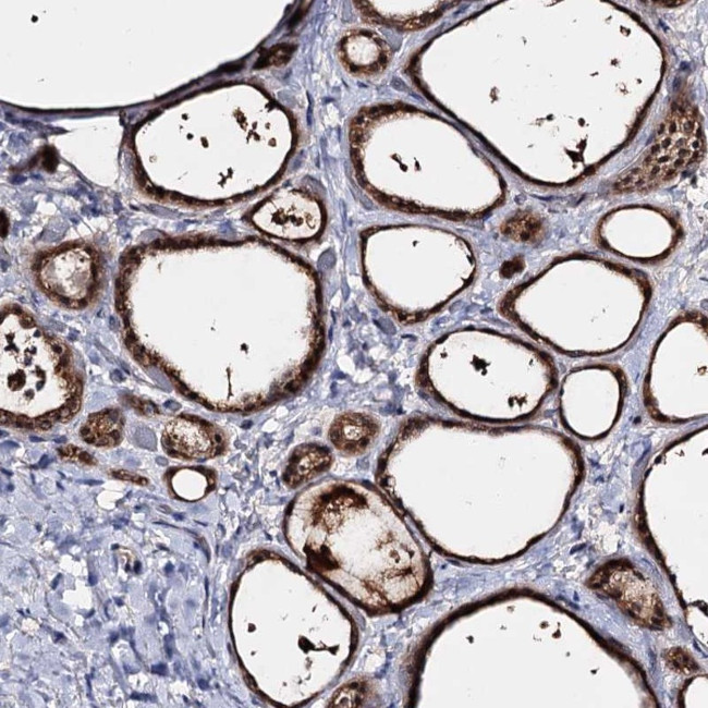ACTR6 Antibody in Immunohistochemistry (Paraffin) (IHC (P))