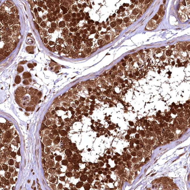 TBCEL Antibody in Immunohistochemistry (Paraffin) (IHC (P))