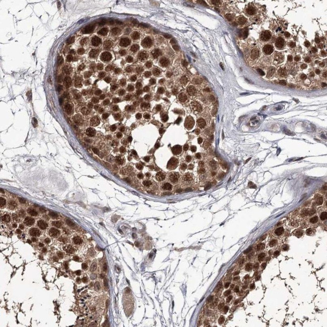 PRPF40B Antibody in Immunohistochemistry (IHC)