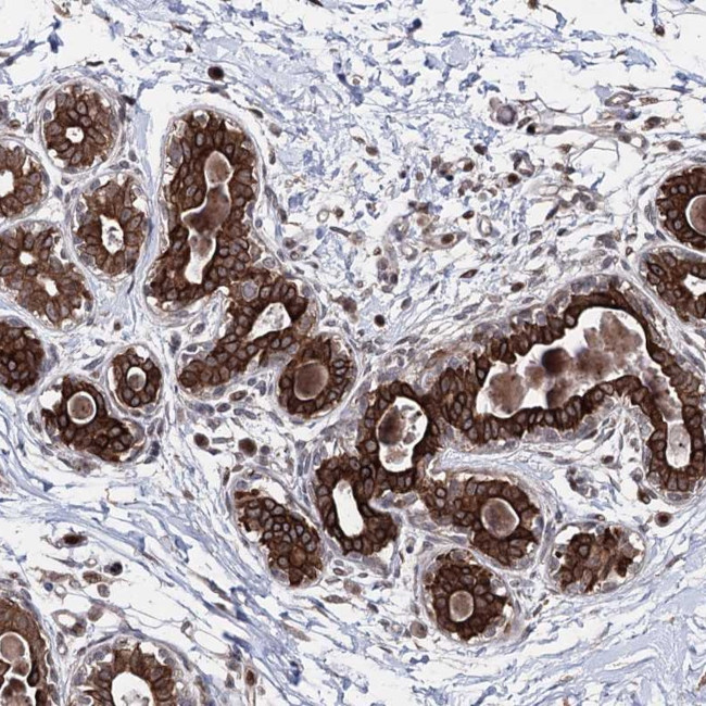 CPNE8 Antibody in Immunohistochemistry (Paraffin) (IHC (P))