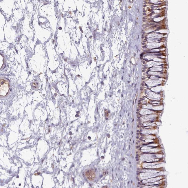 CTRP5 Antibody in Immunohistochemistry (Paraffin) (IHC (P))