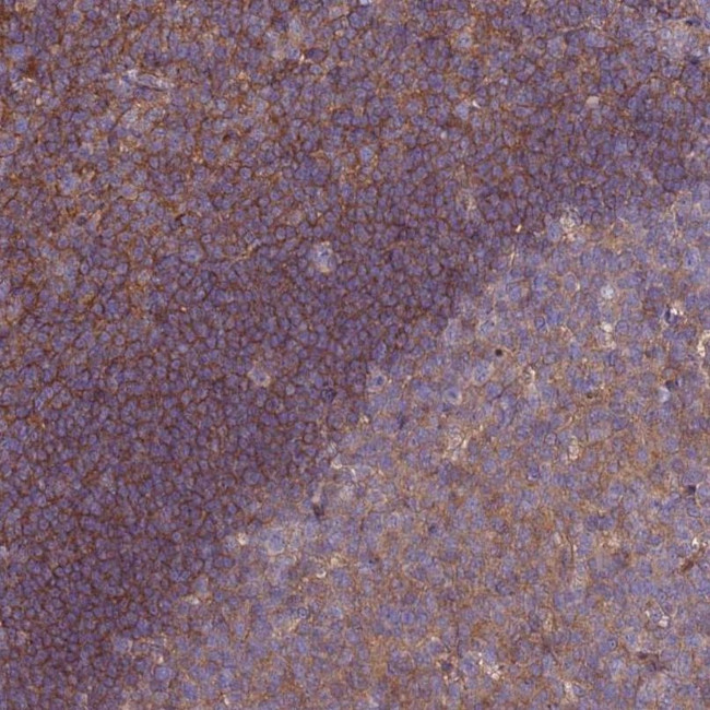 STK38L Antibody in Immunohistochemistry (IHC)