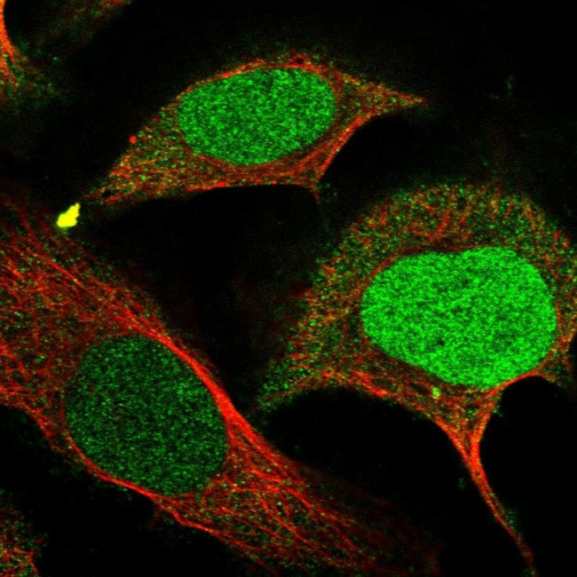 FAM111B Antibody in Immunocytochemistry (ICC/IF)