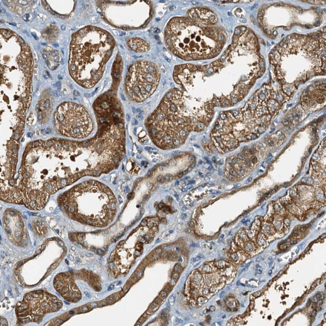 C10orf90 Antibody in Immunohistochemistry (Paraffin) (IHC (P))