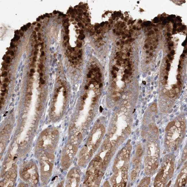 SLC41A2 Antibody in Immunohistochemistry (Paraffin) (IHC (P))
