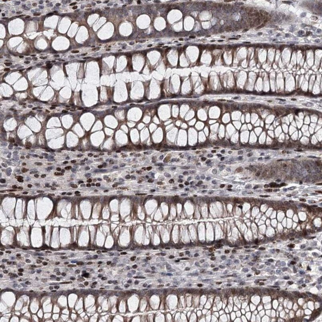 ITFG2 Antibody in Immunohistochemistry (IHC)