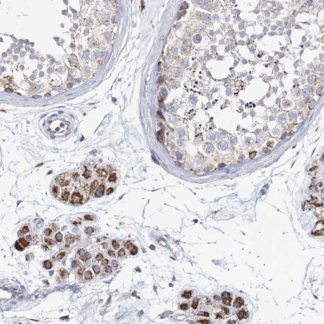 CCDC73 Antibody in Immunohistochemistry (Paraffin) (IHC (P))