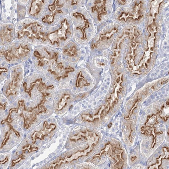 CCDC73 Antibody in Immunohistochemistry (Paraffin) (IHC (P))