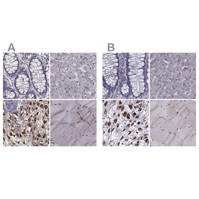 IKBIP Antibody in Immunohistochemistry (IHC)