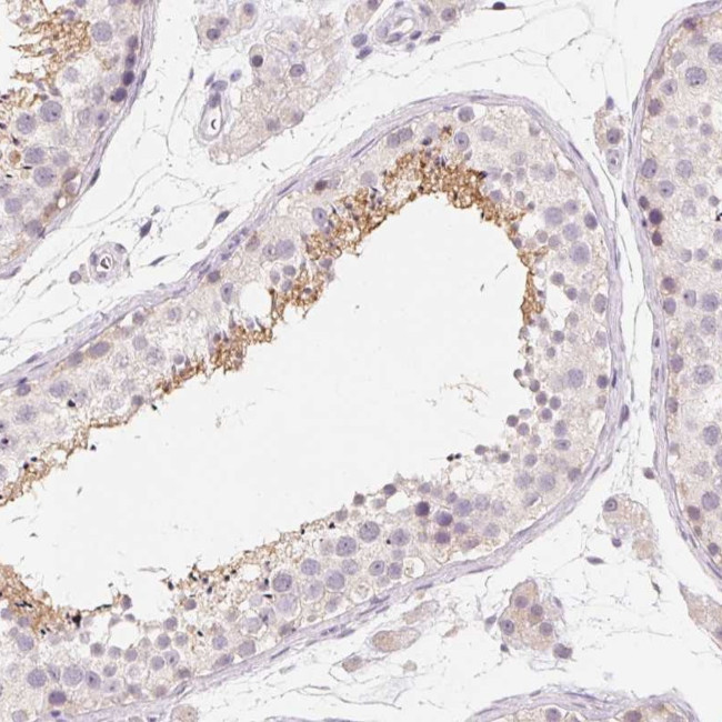 CAPZA3 Antibody in Immunohistochemistry (Paraffin) (IHC (P))