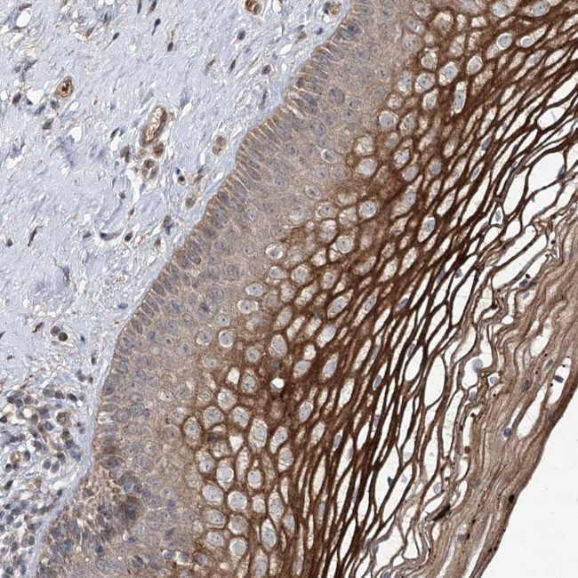 MSANTD2 Antibody in Immunohistochemistry (Paraffin) (IHC (P))