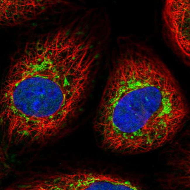 FGFR1OP2 Antibody in Immunocytochemistry (ICC/IF)