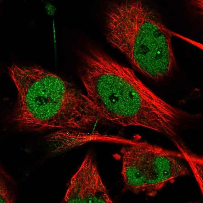 MON2 Antibody in Immunocytochemistry (ICC/IF)