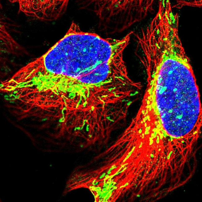 TRPT1 Antibody in Immunocytochemistry (ICC/IF)