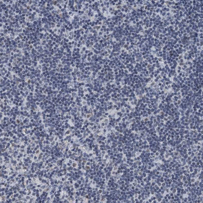 TRPT1 Antibody in Immunohistochemistry (Paraffin) (IHC (P))