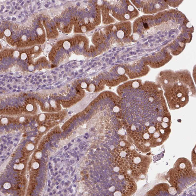 PRAP1 Antibody in Immunohistochemistry (Paraffin) (IHC (P))