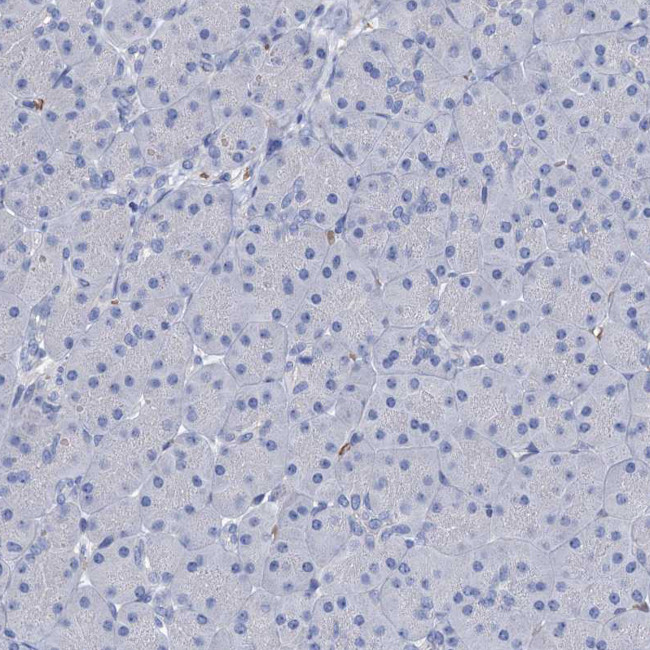 ATG2A Antibody in Immunohistochemistry (Paraffin) (IHC (P))