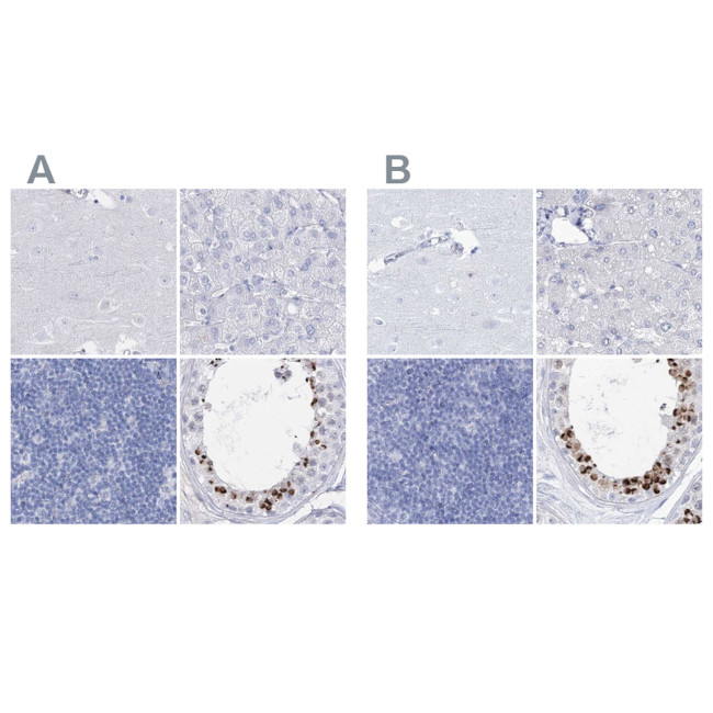 Acrosomal Vesicle Protein Antibody in Immunohistochemistry (IHC)
