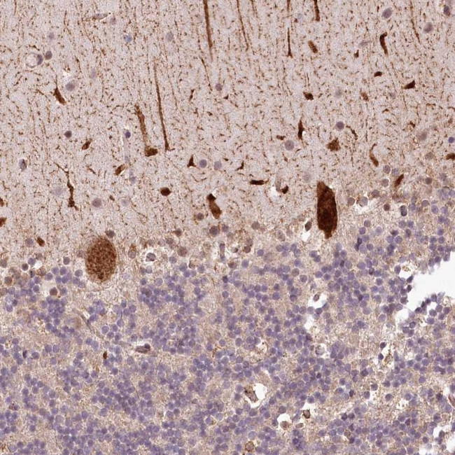 ALKBH8 Antibody in Immunohistochemistry (Paraffin) (IHC (P))