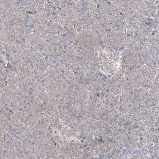 ALKBH8 Antibody in Immunohistochemistry (Paraffin) (IHC (P))