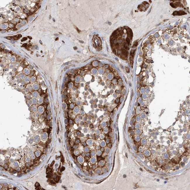 LRRC56 Antibody in Immunohistochemistry (Paraffin) (IHC (P))