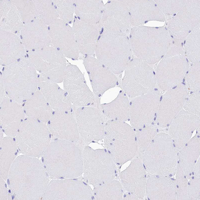 TTC36 Antibody in Immunohistochemistry (Paraffin) (IHC (P))