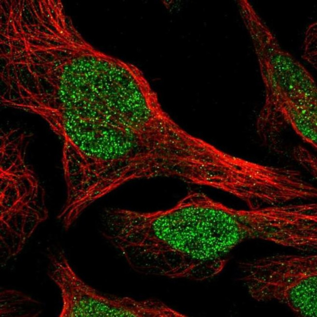 AP3B1 Antibody in Immunocytochemistry (ICC/IF)