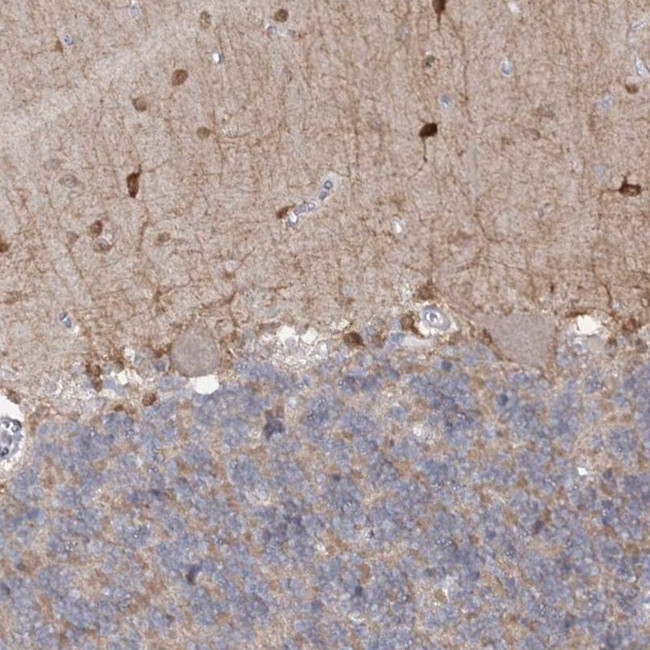 PHYHIPL Antibody in Immunohistochemistry (IHC)