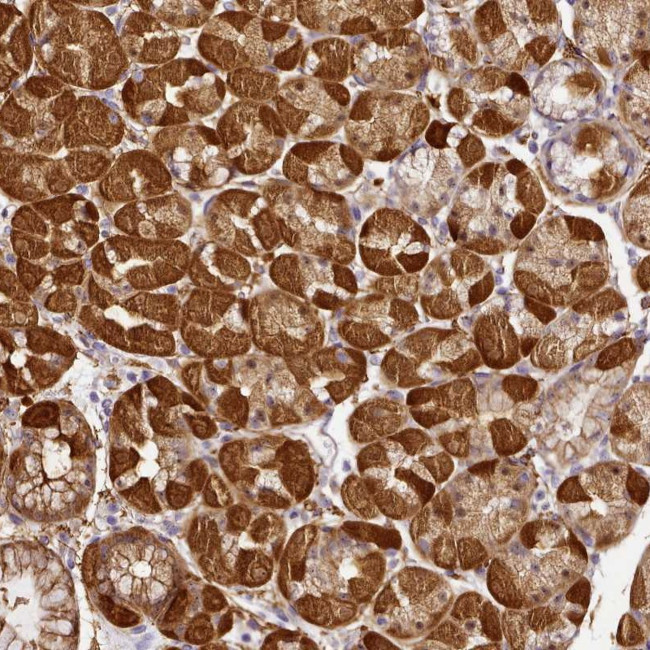 NBPF11 Antibody in Immunohistochemistry (Paraffin) (IHC (P))
