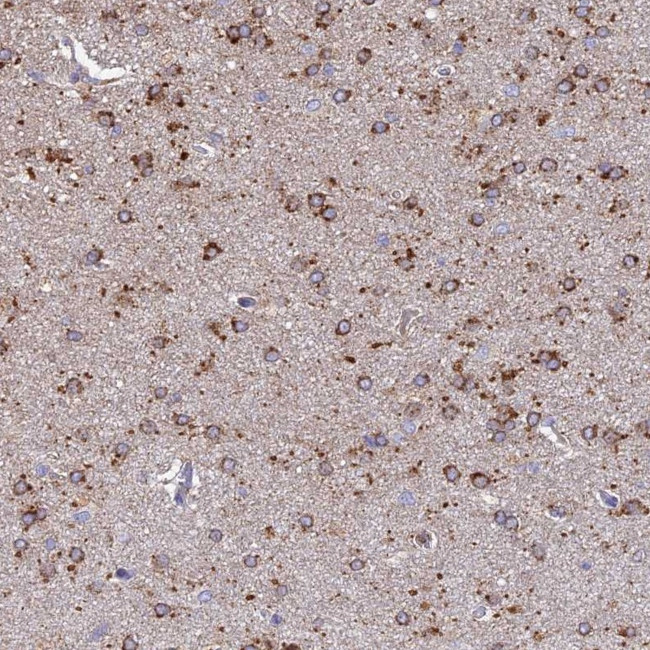 ARL8A Antibody in Immunohistochemistry (Paraffin) (IHC (P))