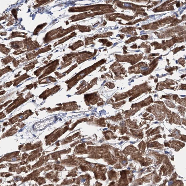 EYA4 Antibody in Immunohistochemistry (Paraffin) (IHC (P))