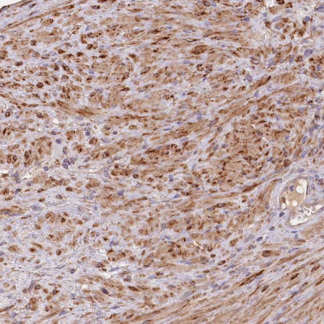 FUNDC1 Antibody in Immunohistochemistry (IHC)
