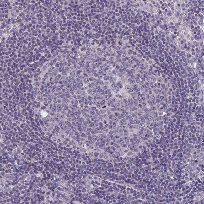 LRRC38 Antibody in Immunohistochemistry (Paraffin) (IHC (P))