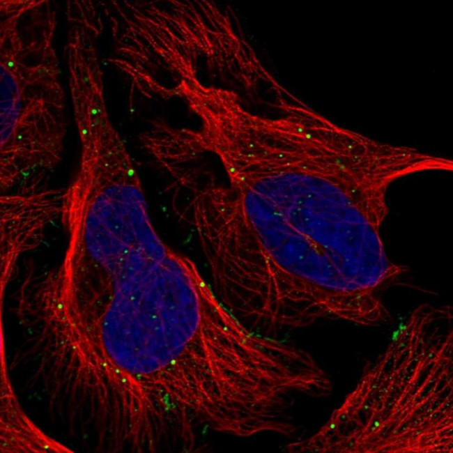TMEM164 Antibody in Immunocytochemistry (ICC/IF)